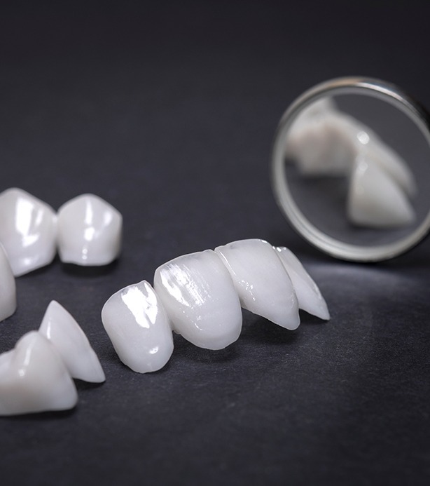 Dental veneers laying on a table